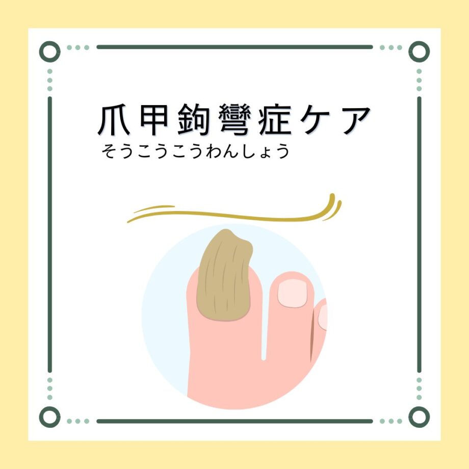 【症例紹介】ガタガタして厚くなり盛り上がった爪（爪甲鉤彎症）が初回ケアで平らに整い、痛みも軽減！