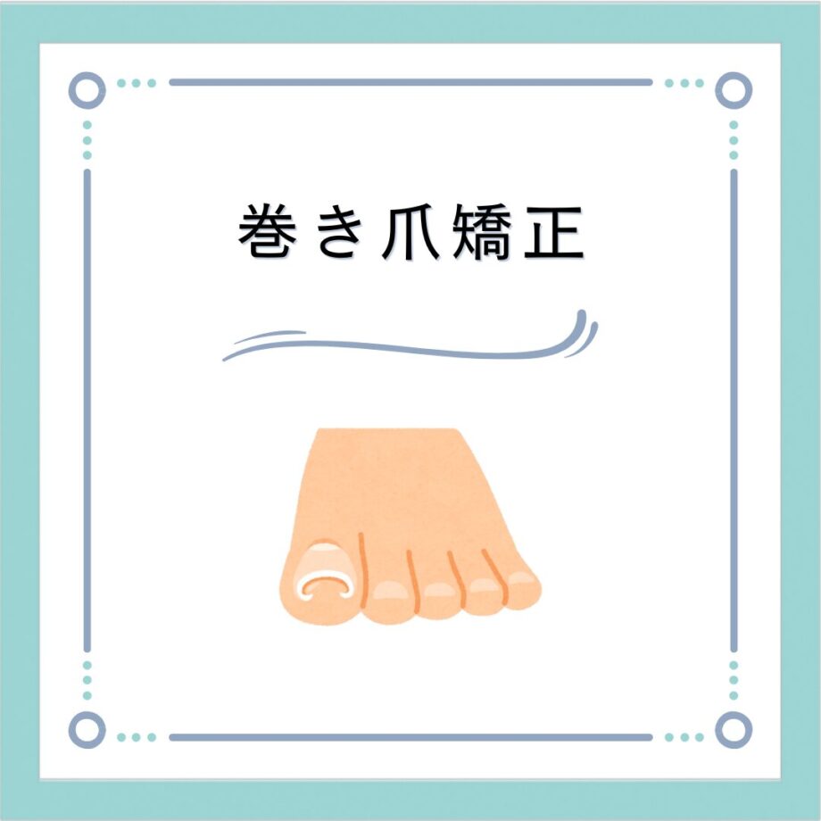 【巻き爪ケアの症例】半年で大きく変化した“自分で切れない巻き爪”