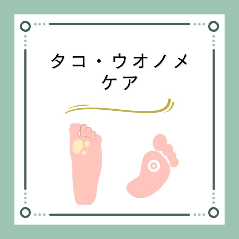 足裏のタコ（胼胝）・魚の目は“未来のサイン”違和感の放置がもたらす影響とケアの重要性